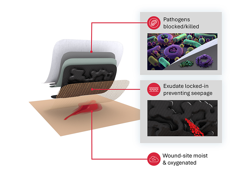 Ashwinraj Karthikeyan developed a dressing for wounds that uses activated carbon to improve the healing process.